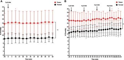 Impediment of Cerebrospinal Fluid Drainage Through Glymphatic System in Glioma